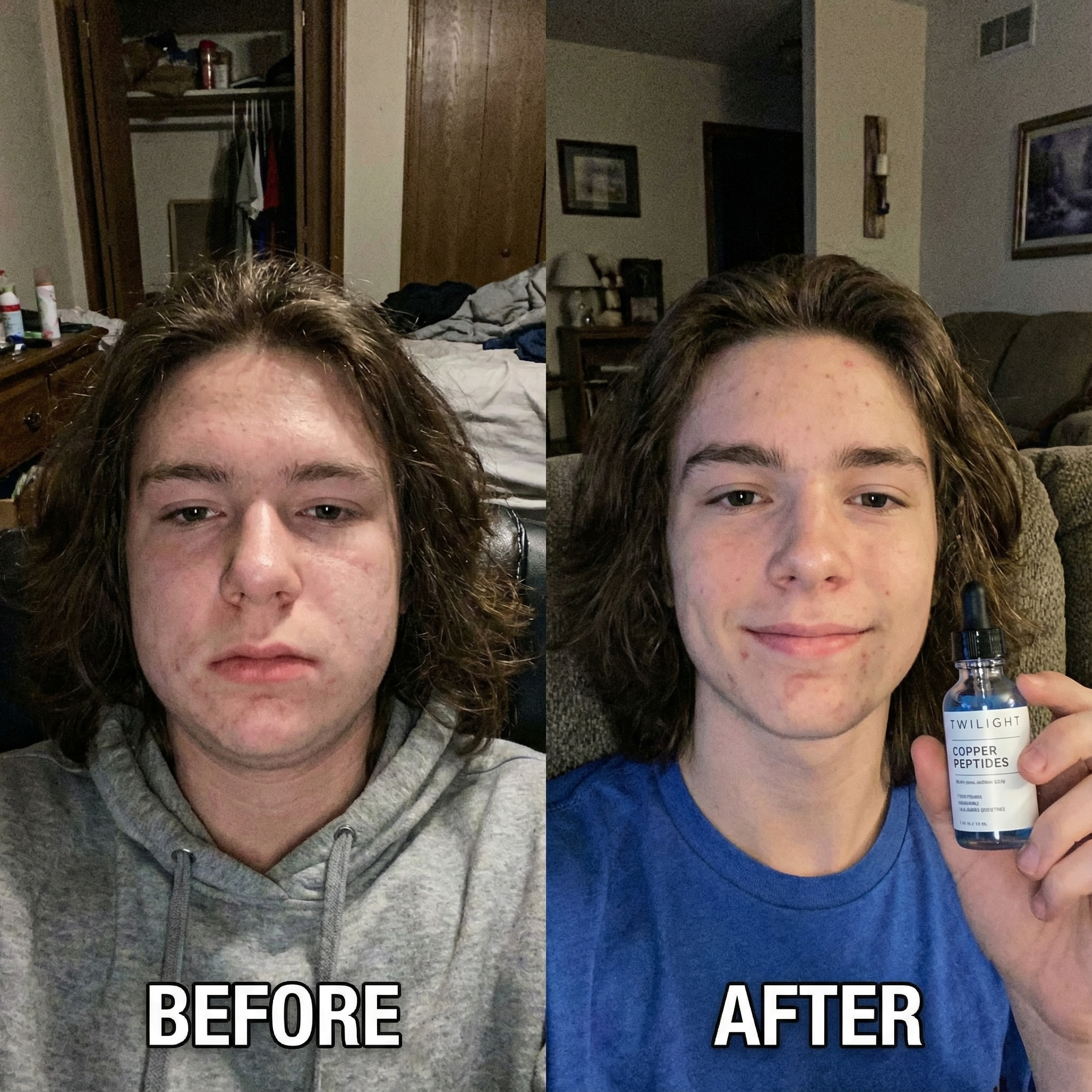 GHK-CU Peptides Serum